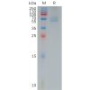 sp-pme101185 trpv1 sp1