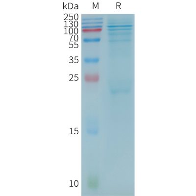 sp-pme101186 btk sp1