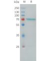 sp-pme101187 lgals3bp sp1