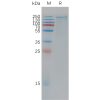 sp-pme101193 lrp6 sp1