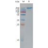 sp-pme101194 sez6 sp1