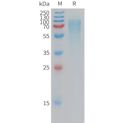 sp-pme101196 anprb sp1