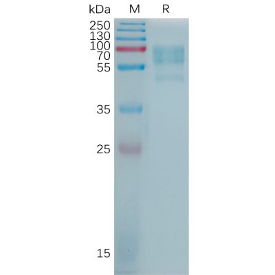 sp-pme101204 cadm1 sp1