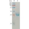 sp-pme101212 angpt2 sp1