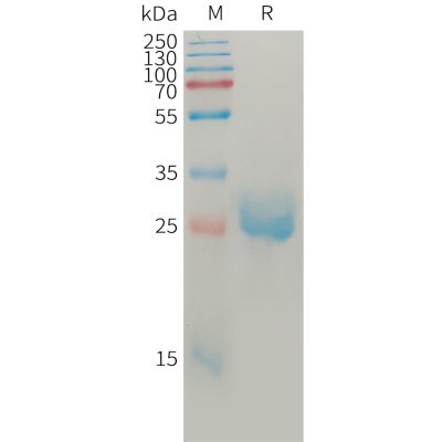 sp-pme101212 angpt2 sp1