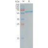 sp-pme101242 alpp sp1