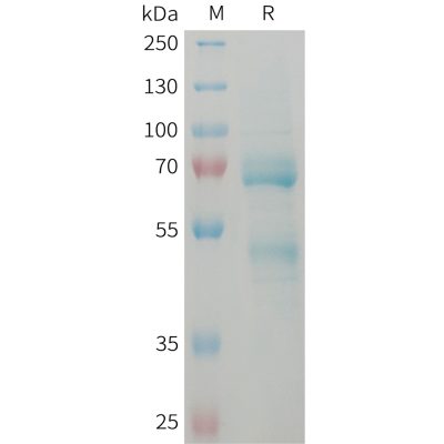 sp-pme101373 ccn2 sp1