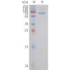 sp-pme101429 fstl3 sp1