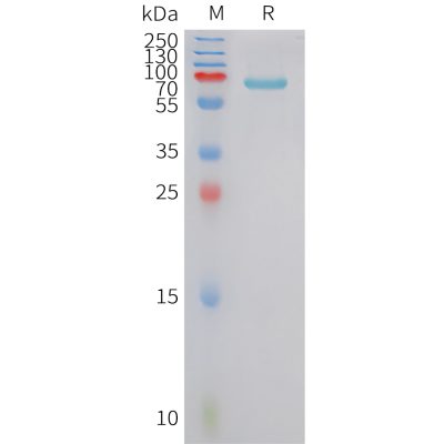 sp-pme101429 fstl3 sp1
