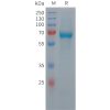 sp-pme101438 c9 sp1