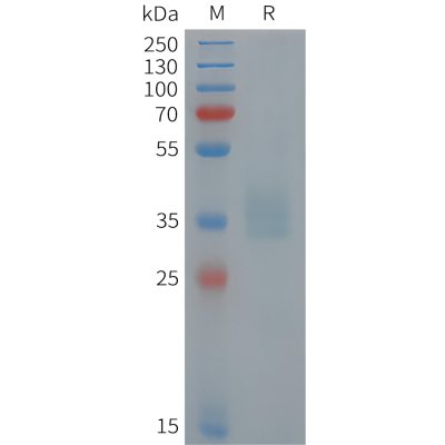 sp-pme101449 pomc sp1