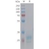 sp-pme101453 hmgb1 sp1
