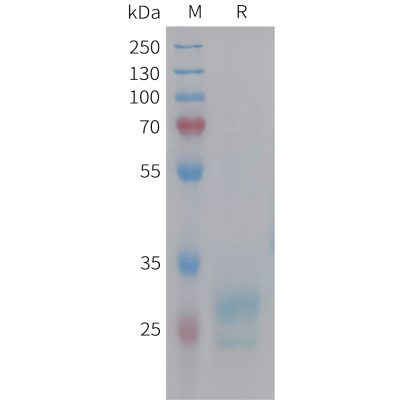 sp-pme101453 hmgb1 sp1