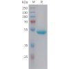 sp-pme101456 ngal sp1