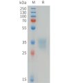 sp-pme101474 efnb1 sp1