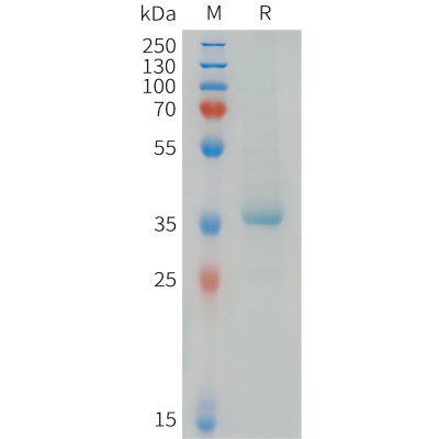 sp-pme101477 ccl22 sp1