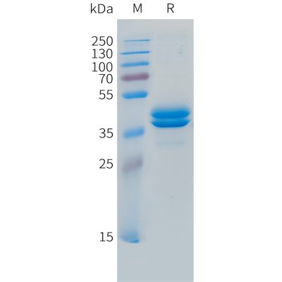 sp-pme101487 ccl7 sp1