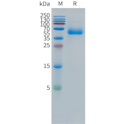 sp-pme101497 ceacam5 sp1