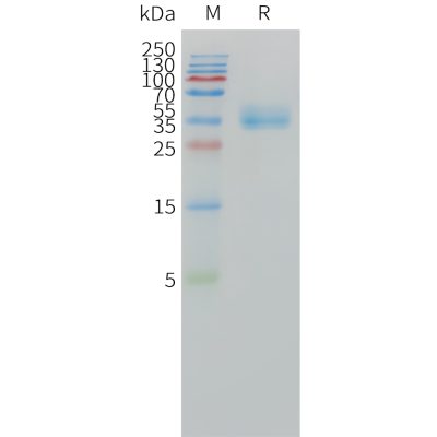 sp-pme101501 ca12 sp1