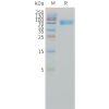 sp-pme101502 il1ra sp1