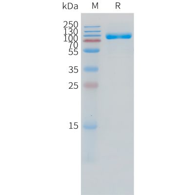 sp-pme101503 il1r2 sp1