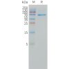 sp-pme101504 dll3 sp1 1