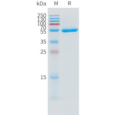 sp-pme101506 il1a sp1