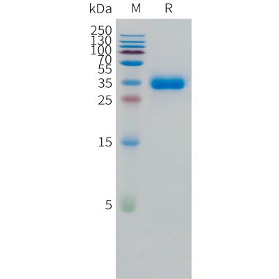 sp-pme101510 cd2 sp1