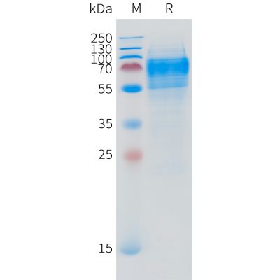 sp-pme101515 dpep3 sp1