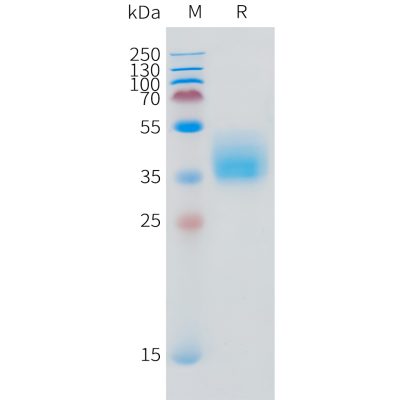 sp-pme101516 ifngr1 sp1 1