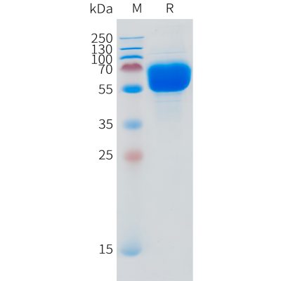 sp-pme101518 slc44a4 sp1 1