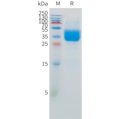 sp-pme101527 ifnar2 sp1