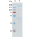 sp-pme101533 adamts13 sp1