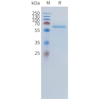 sp-pme101536 alpl sp1