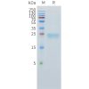 sp-pme101537 tnfsf15 sp1
