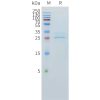 sp-pme101540 clec1a sp1
