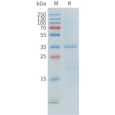 sp-pme101548 apoe4 sp1