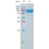 sp-pme101551 acvr2b sp1