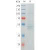 sp-pme101552 rnf133 sp1