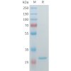 sp-pme101554 hsd17b10 sp1