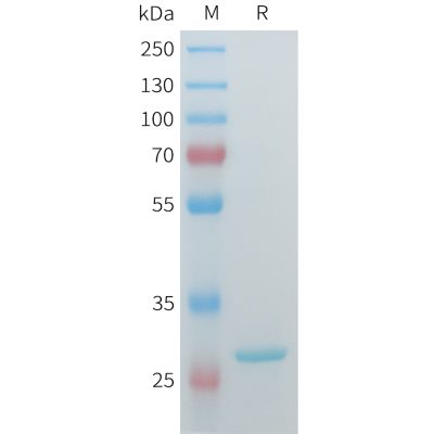 sp-pme101554 hsd17b10 sp1