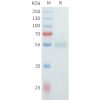 sp-pme101556 clm5 sp1