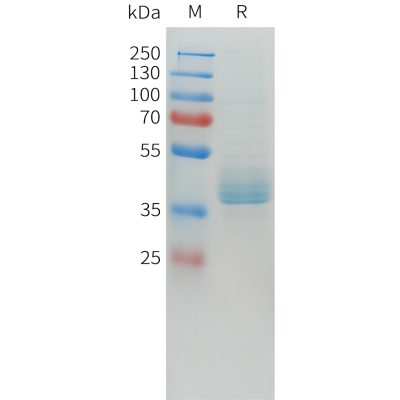 sp-pme101562 cdh17 sp1