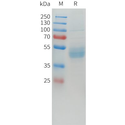 sp-pme101565 cdh17 sp1