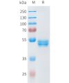 sp-pme101594 ror2 sp1