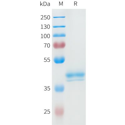 sp-pme101595 ror2 sp1