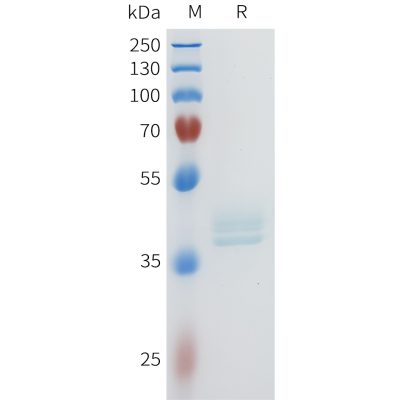 sp-pme101602 cd117 sp1