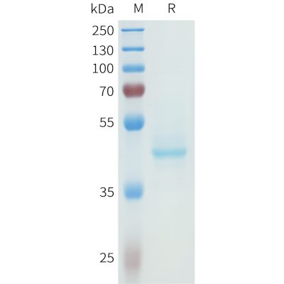 sp-pme101614 cdh3 sp1