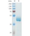 sp-pme101616 cdh3 sp1