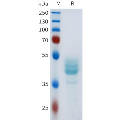 sp-pme101623 cdh17 sp1